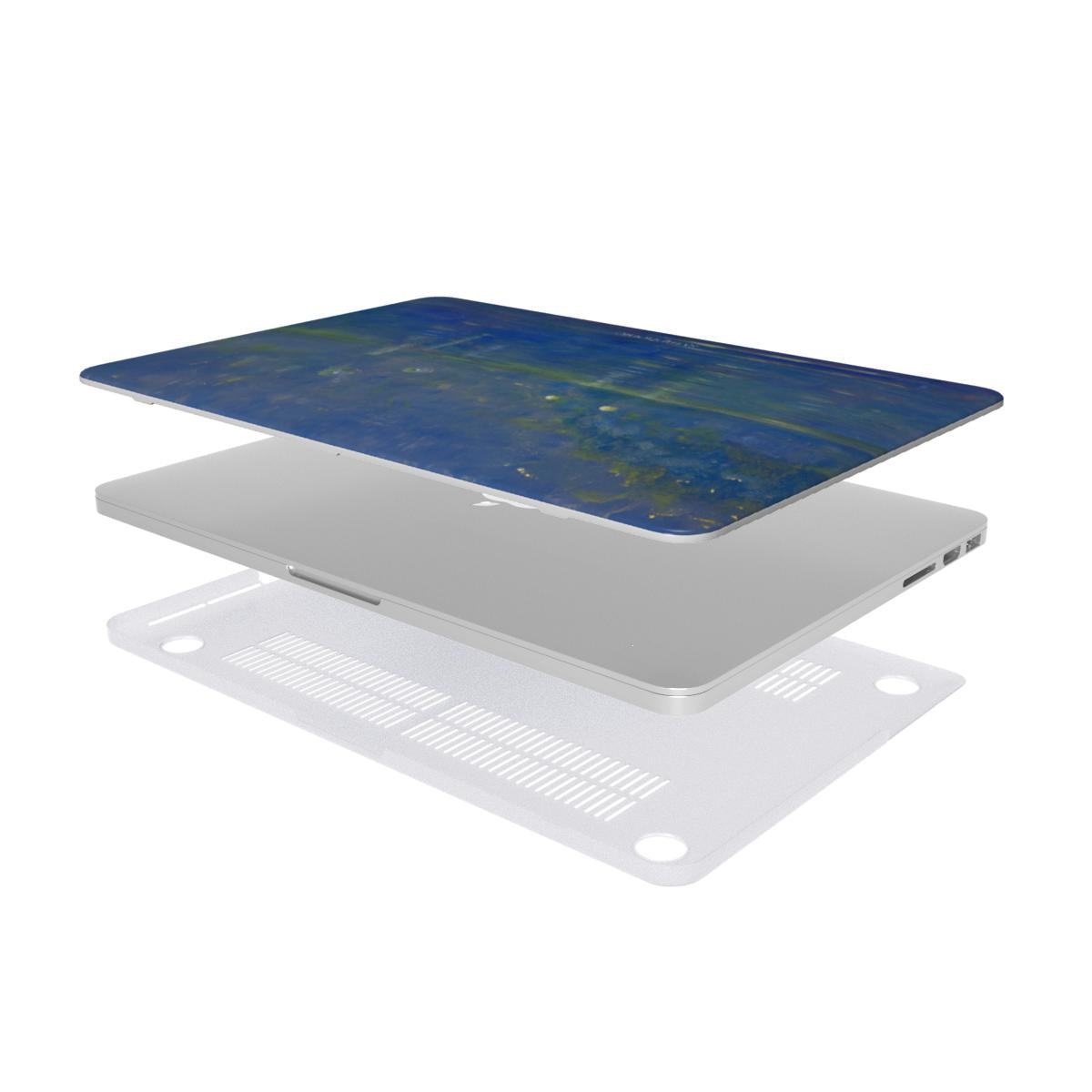 Creation of the World V - MacBook Case