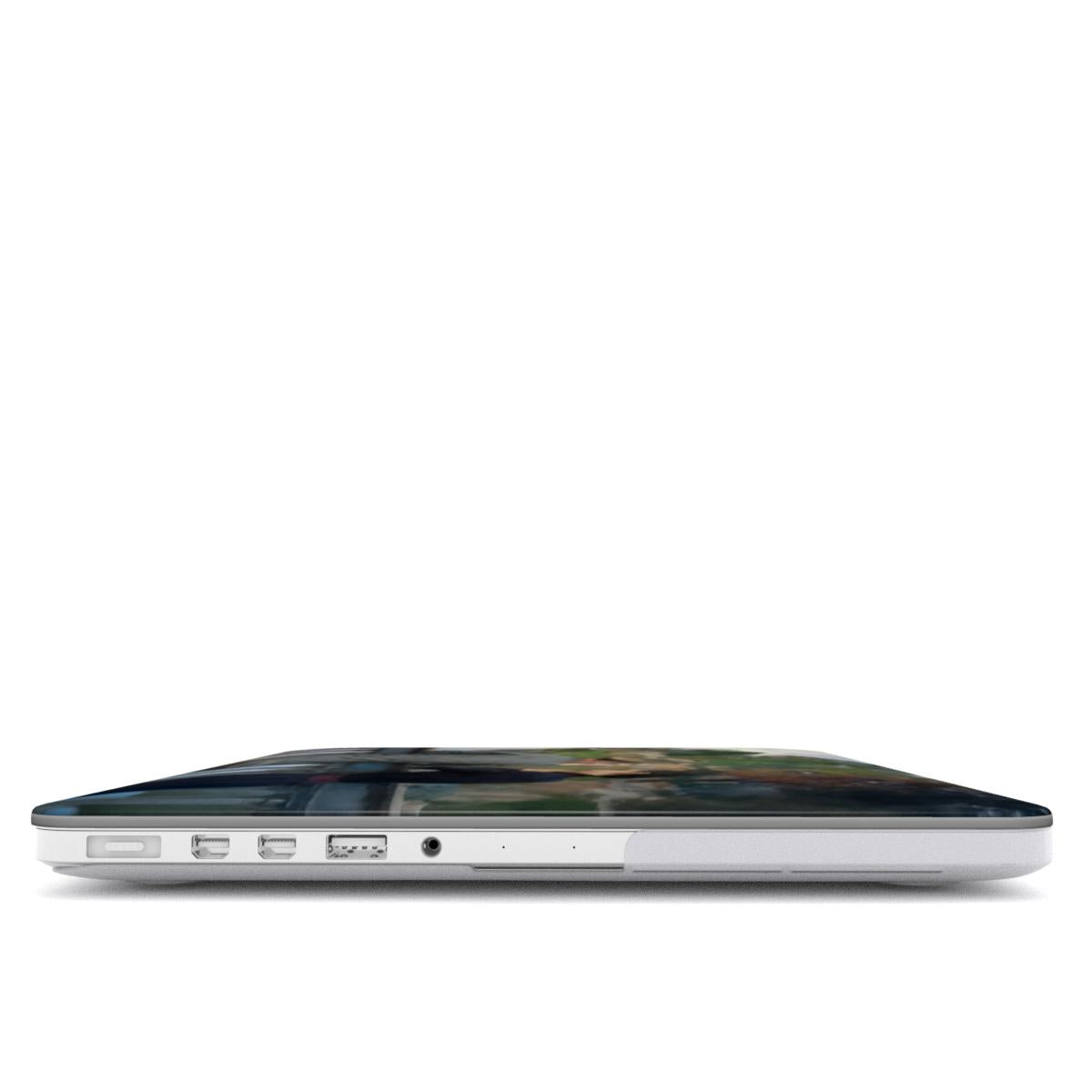 The Lovers - MacBook Case